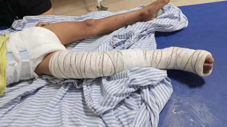 Criança de cinco anos é atropelada em Ilha Solteira e motociclista foge sem prestar socorro crianca-de-cinco-anos-e-atropelada-em-ilha-solteira-e-motociclista-foge-sem-prestar-socorro